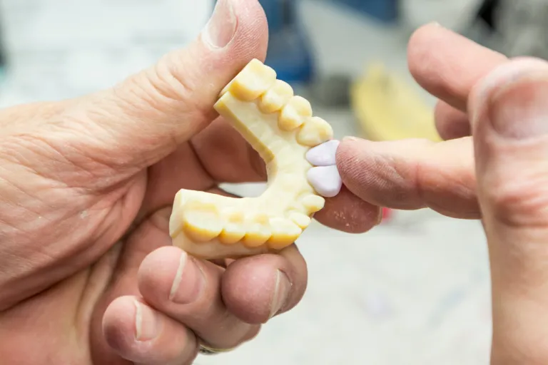 補綴物を成形する歯科技工士